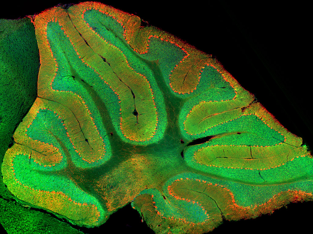 Image showing granule cells in the cerebellum