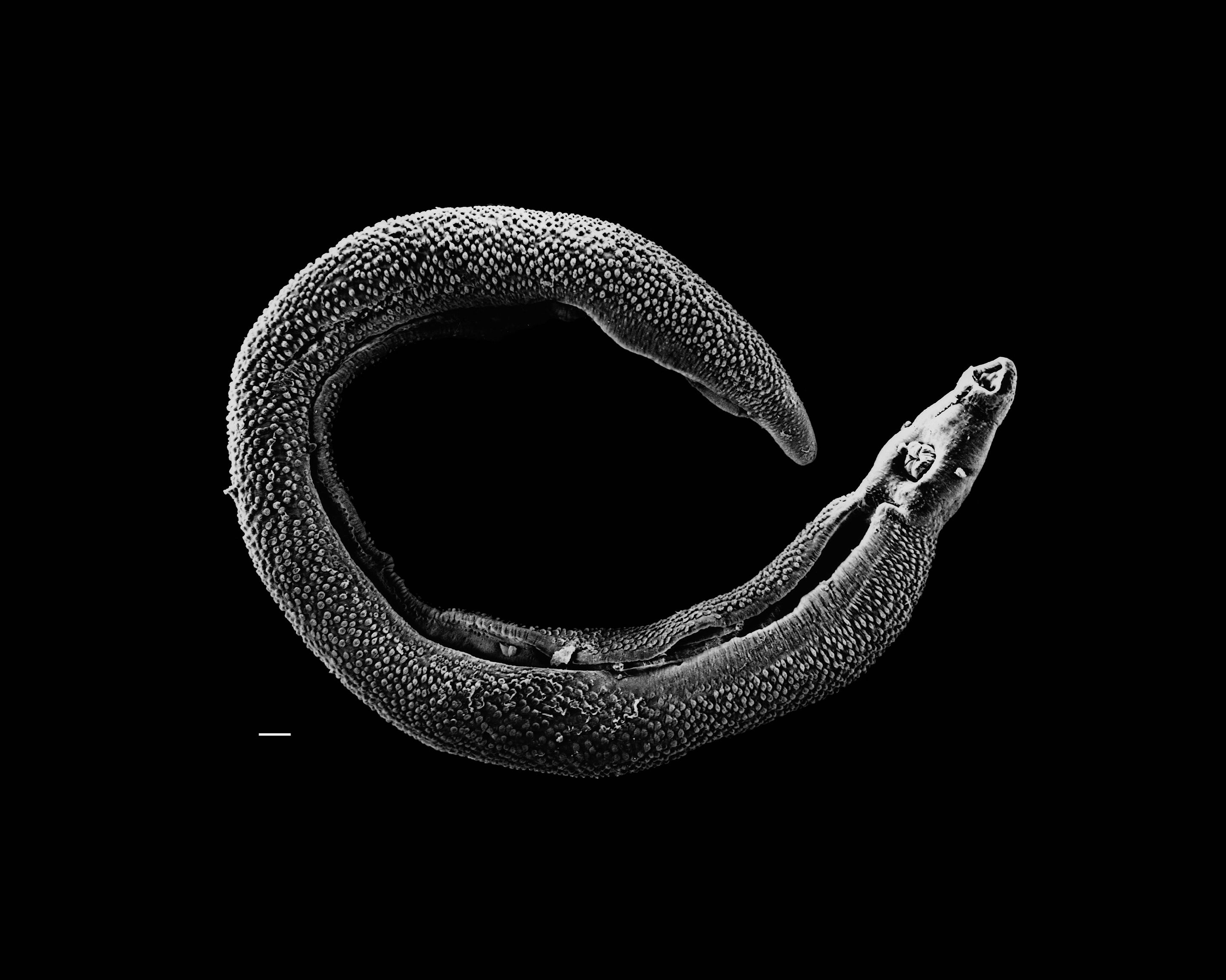 Electron micrograph of an adult male Schistosoma parasite worm. The bar (bottom left) represents a magnification of 500 μm.