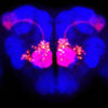 Drosophila brain with various olfactory neurons labeled by different-colored fluorescent markers