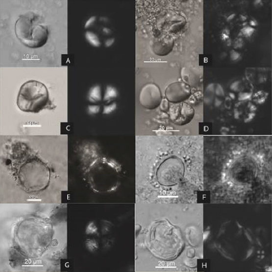 Microscopic traces of ancient starches