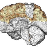 image of a computer model showing amyloid beta proteins throughout brain in dementia cases