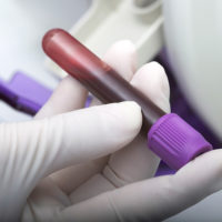 Blood sample in tube