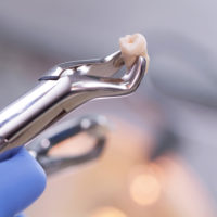 Dental equipment holding an extracted tooth