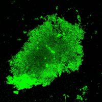 Green, glowing tuberculosis in a sputum sample.