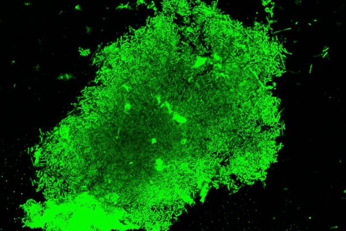 Green, glowing tuberculosis in a sputum sample.