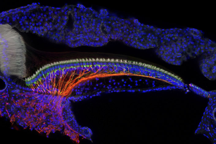 Inner ear cells