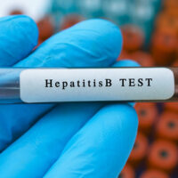 Hepatitis B (HBV) virus blood test tube.