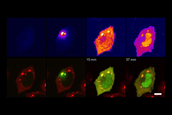 Eight fluorescent microscope images of cells